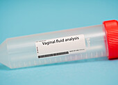 Vaginal fluid analysis