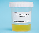Vanillylmandelic acid test