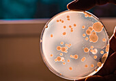 Microorganisms in petri dish
