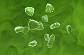 Silver birch pollen grains, illustration