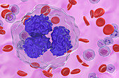 Follicular lymphoma cells, illustration