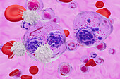 T cells attacking multiple myeloma cell, illustration
