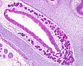 Developing maxillary sinus, light micrograph