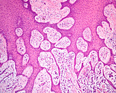 Human gingiva epithelium, light micrograph