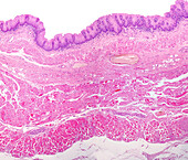 Human oesophagus mucosa, light micrograph