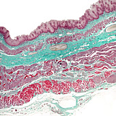 Human oesophagus, light micrograph