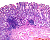 Human gastric mucosa, light micrograph