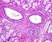 Human sublingual gland, light micrograph