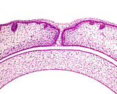 Developing eyelids, light micrograph
