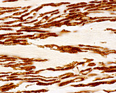 Ciliary body pigment, light micrograph