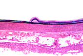 Human retina and ora serrata, light micrograph