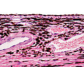 Choroid, light micrograph