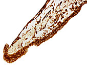 Iris melanin, light micrograph