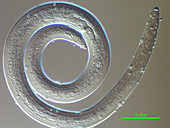 Pasteuria sp. bacteria parasitising a spiral nematode, light micrograph