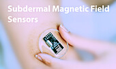 Subdermal magnetic field sensors, conceptual image