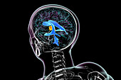 Third brain ventricle, illustration