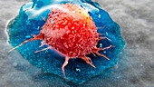 Hydrogel cancer therapy, illustration