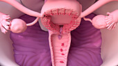 Uterus and vagina during menstruation, illustration