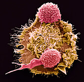 Macrophage and T cells, SEM