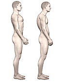 Good and bad body posture, illustration