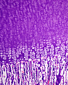 Growth plate of developing bone, light micrograph