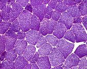 Muscle fibres, light micrograph