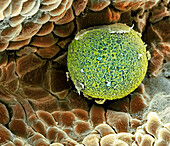 Human ovum in fallopian tube, SEM