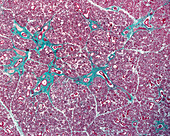 Submandibular gland, light micrograph