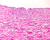 Vein wall, light micrograph