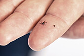 Black-legged ticks on a person's finger