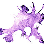 Migrating Ewing sarcoma cancer cell, confocal light micrograph