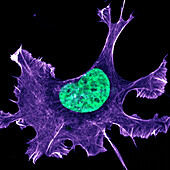 Migrating Ewing sarcoma cancer cell, confocal light micrograph