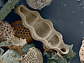 Fossilised Biddulphia sp. diatom, SEM