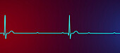 Complete heart block electrocardiogram, illustration