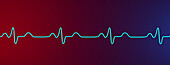 Bundle branch block electrocardiogram, illustration