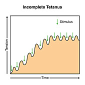 Incomplete tetanus muscle contraction, illustration