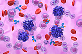 Monoclonal antibody therapy for diffuse large B-cell lymphoma, illustration