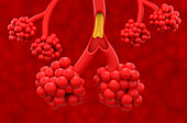 Cystic fibrosis, illustration