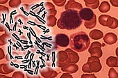 Human chromosomes and red blood cells, illustration