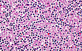 Lymphocytes and other blood cells, light micrograph