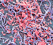 Middle East Respiratory Syndrome, SEM
