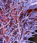 Middle East Respiratory Syndrome, SEM