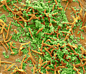 Middle East Respiratory Syndrome, SEM