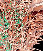 Middle East Respiratory Syndrome, SEM