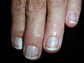 Terry's nails
