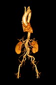 Torso blood vessels, 3D CT scan