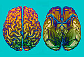 Human brain from above and below, 3D MRI scans
