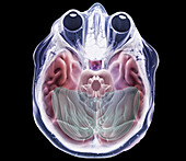 Human brain and eyes, 3D MRI scan