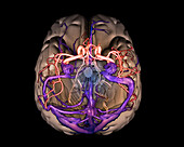 Brain arteries and veins, 3D MRI scan