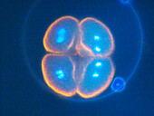 Sea urchin embryo, four-cell stage
